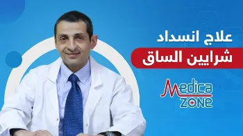 دليلك الشامل عن طرق علاج انسداد شرايين الساقين