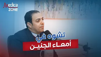 علاج العيوب الخلقية في جدار البطن لحديثي الولادة