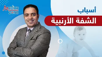 تعرف على أسباب الشفة الأرنبية وكيفية علاجها