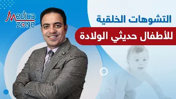 التشوهات الخلقية عند الأطفال حديثي الولادة
