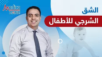 كيفية إجراء عملية الشق الشرجي للأطفال