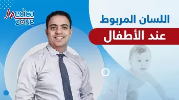 ما هو اللسان المربوط عند الاطفال؟