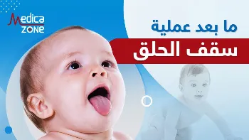 أهم إرشادات ما بعد عملية سقف الحلق لضمان نجاحها