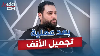 أهم النصائح بعد عملية تجميل الانف