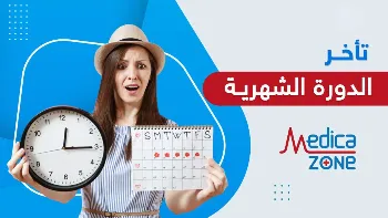 متى يبدأ القلق من تأخر الدورة الشهرية عند الفتيات؟