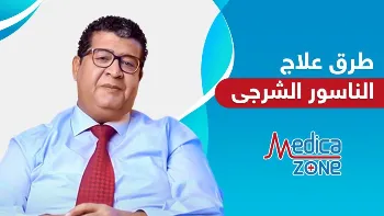 هل الجراحة أفضل طرق علاج الناسور الشرجي؟ معايير هامة لاختيار وسيلة العلاج المناسبة