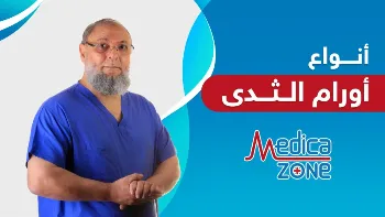 انواع اورام الثدي الحميدة والخبيثة