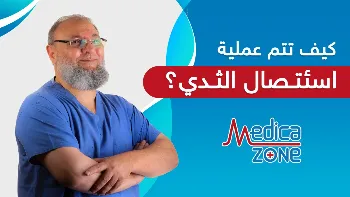 متى يجب إجراء عملية استئصال الثدي الوقائي؟