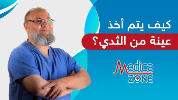 كيف يتم أخذ عينة من الثدي للكشف عن الأورام؟