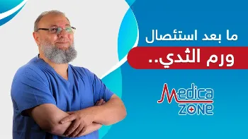 نصائح ما بعد استئصال ورم الثدي