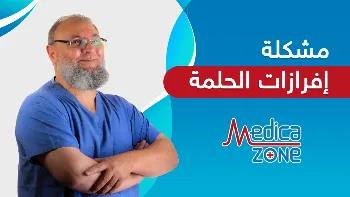 ما أسباب مشكلة إفرازات الحلمة؟