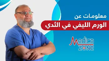 معلومات عن الورم الليفي في الثدي ونسب التعافي منه