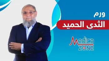كيف يُشخص ورم الثدي الحميد؟ وهل يستدعي علاجه التدخل الجراحي؟