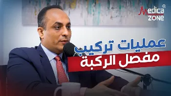 نسبة نجاح عمليات تركيب مفصل الركبة