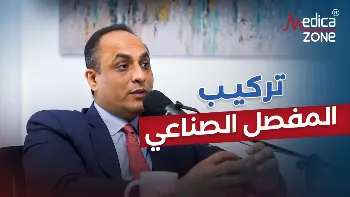 ما عملية تركيب المفصل الصناعي؟