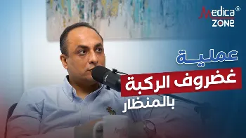 خطوات عملية غضروف الركبة بالمنظار