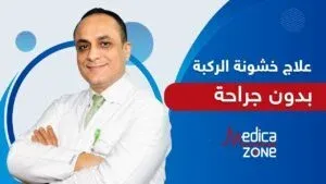 هل يصلح علاج خشونة الركبة بدون جراحة (المنظار الجراحي) لجميع الحالات؟