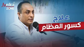 نصائح ذهبية تسهم في علاج كسور العظام بفاعلية