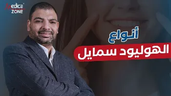 ما هو الهوليود سمايل؟ 