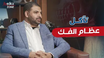 تآكل عظام الفك وتأثيره في زراعة الأسنان