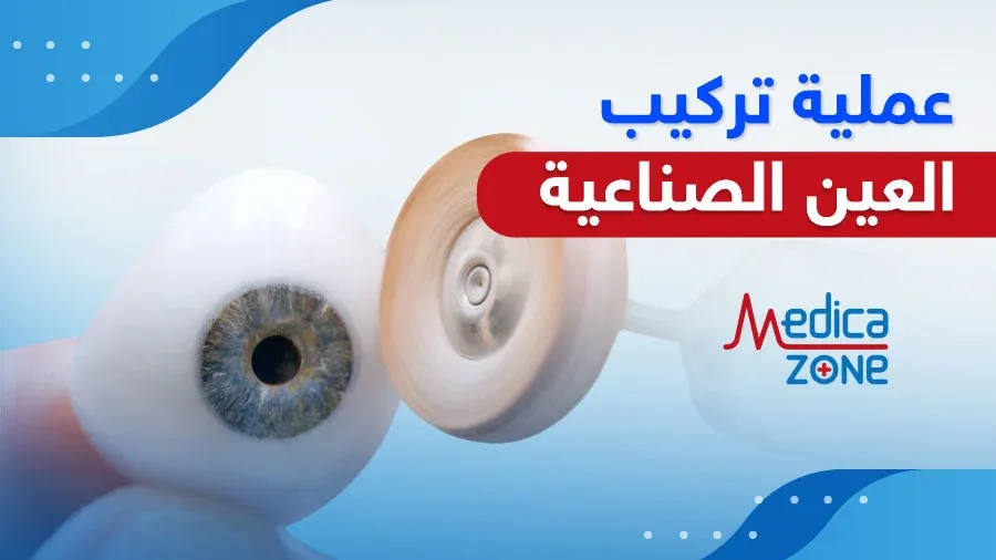 خلفية ميديكازون