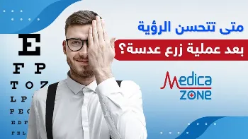 عملية زراعة العدسة لتصحيح النظر | متى تتحسن الرؤية بعد عملية زرع العدسة؟
