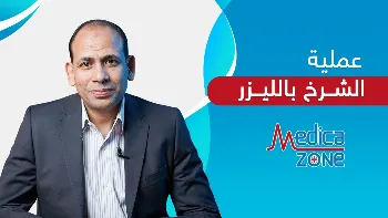 هل عملية الشرخ بالليزر لها مضاعفات خطيرة؟