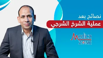 أهم نصائح بعد عملية الناسور الشرجي لضمان سرعة التعافي