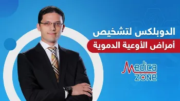 أهمية اشعة الدوبلكس في تشخيص أمراض الأوعية الدموية