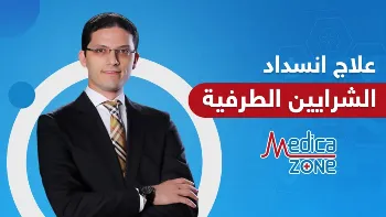 علاج انسداد الشرايين الطرفية