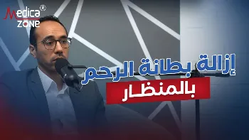 علاج بطانة الرحم المهاجرة بالمنظار