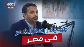 عملية زراعة الشعر فى مصر وتقنياتها المختلفة