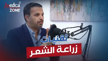 أنواع تقنيات زراعة الشعر