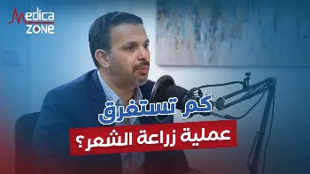 متى تظهر نتائج عملية زراعة الشعر؟
