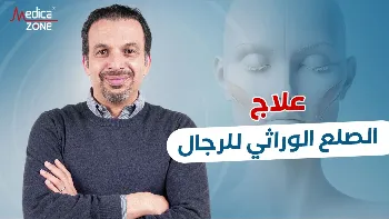 علاج الصلع الوراثي للرجال نهائيًا مع د/ أحمد مكاوي