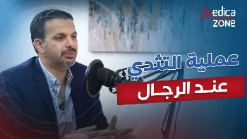 عملية التثدي عند الرجال.. كيف تستعيد ثقتك بنفسك؟