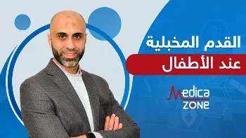 ما هي القدم المخلبية عند الأطفال؟ وما أسبابها وطرق علاجها؟