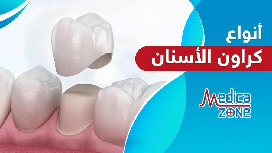 خلفية ميديكازون