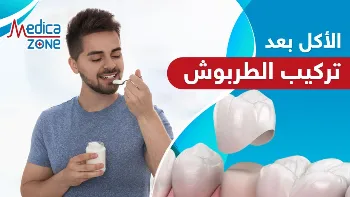 علامَ يعتمد نظام الاكل بعد تركيب الطربوش؟