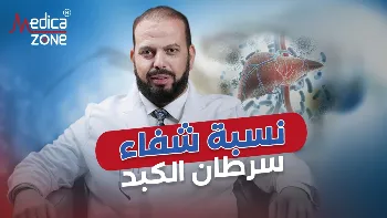 أنواع أورام الكبد وأهم التقنيات العلاجية المستخدمة في التخلص منها