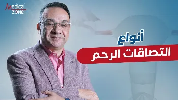 أنواع التصاقات الرحم وأسبابها وعلاجها