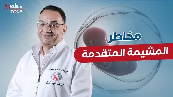 المشيمة المتقدمة… مشكلة صحية تتطلب استعدادًا طبيًا خاصًا