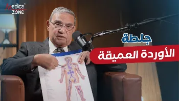 جلطات الأوردة العميقة| أسبابها ووسائل علاجعا 