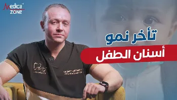 عادات خاطئة قد تؤثر في نمو الأسنان والفكين عند الأطفال