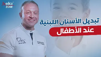 أهمية متابعة تبديل الأسنان اللبنية عند الأطفال مع طبيب الأسنان
