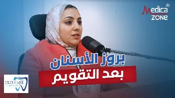 بروز الأسنان بعد التقويم| الأسباب الخفية والحلول الجذرية