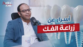 اكتشاف زرع الأسنان بالصدفة| القصة وراء الابتكار الطبي المذهل
