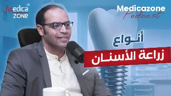 إجراء زرع الأسنان باستخدام التقنيات الحديثة