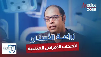 هل يمكن زراعة الأسنان لأصحاب الأمراض المناعية؟