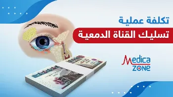 تكلفة عملية تسليك القناة الدمعية